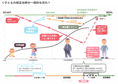 子供の矯正治療の場合